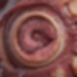 An anatomical illustration of the pancreas highlighting areas affected by chronic pancreatitis.