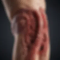 Illustration depicting the relationship between colon cancer and bleeding