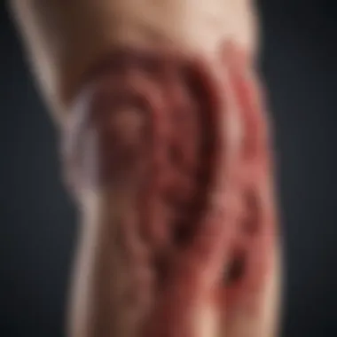 The Interconnection of Colon Cancer and Bleeding Illustration depicting the relationship between colon cancer and bleeding