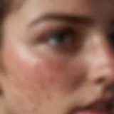 A close-up of a facial rash illustrating a dermatological condition.