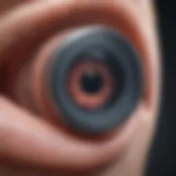 Detailed diagram of a glaucoma valve