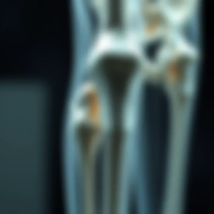 In-Depth Exploration of Osteoporosis Research Summary