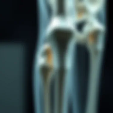 In-Depth Exploration of Osteoporosis Research Summary In-Depth Exploration of Osteoporosis Research Summary