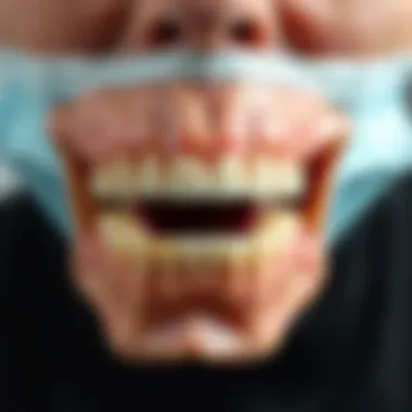 Notable Incidence of Osteonecrosis of the Jaw Associated with Prolia Treatment