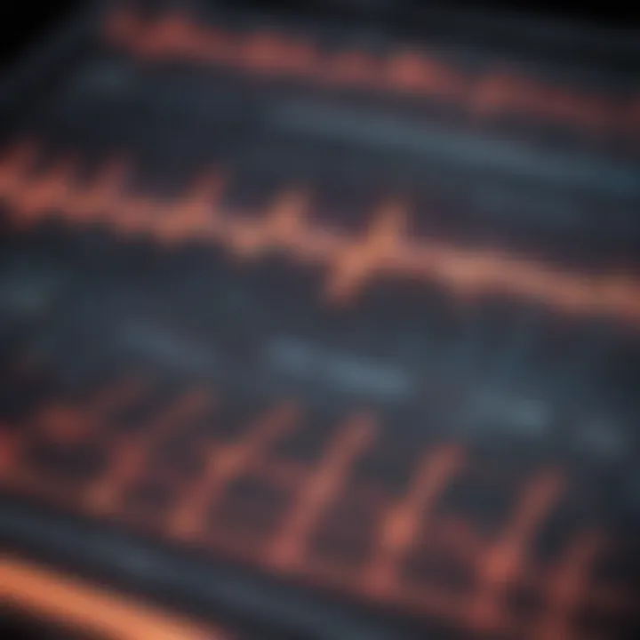 Electrocardiogram showing myocardial infarction indicators