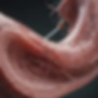 Expected Outcomes of Renal Embolization Outcomes of renal embolization