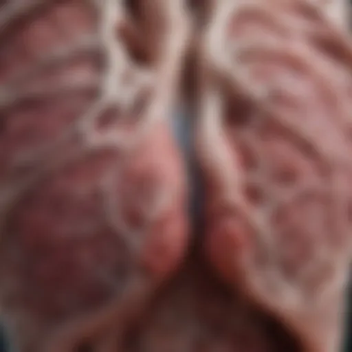 Detailed illustration of lung interstitium affected by fibrosis