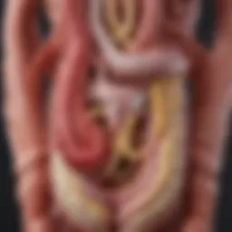 Illustration depicting the gastrointestinal tract affected by diverticulitis