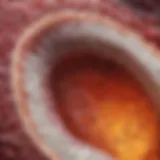 Cross-section of lung tissue exhibiting honeycomb changes