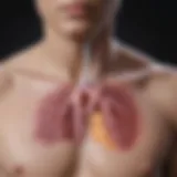 Illustration depicting pleural effusion in a medical context