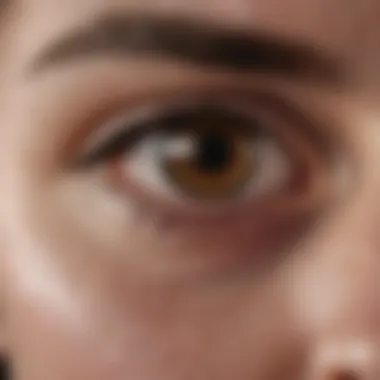 Clinical Implications of McLeod Eye Phenomenon Graphical representation of the clinical implications associated with the McLeod eye phenomenon